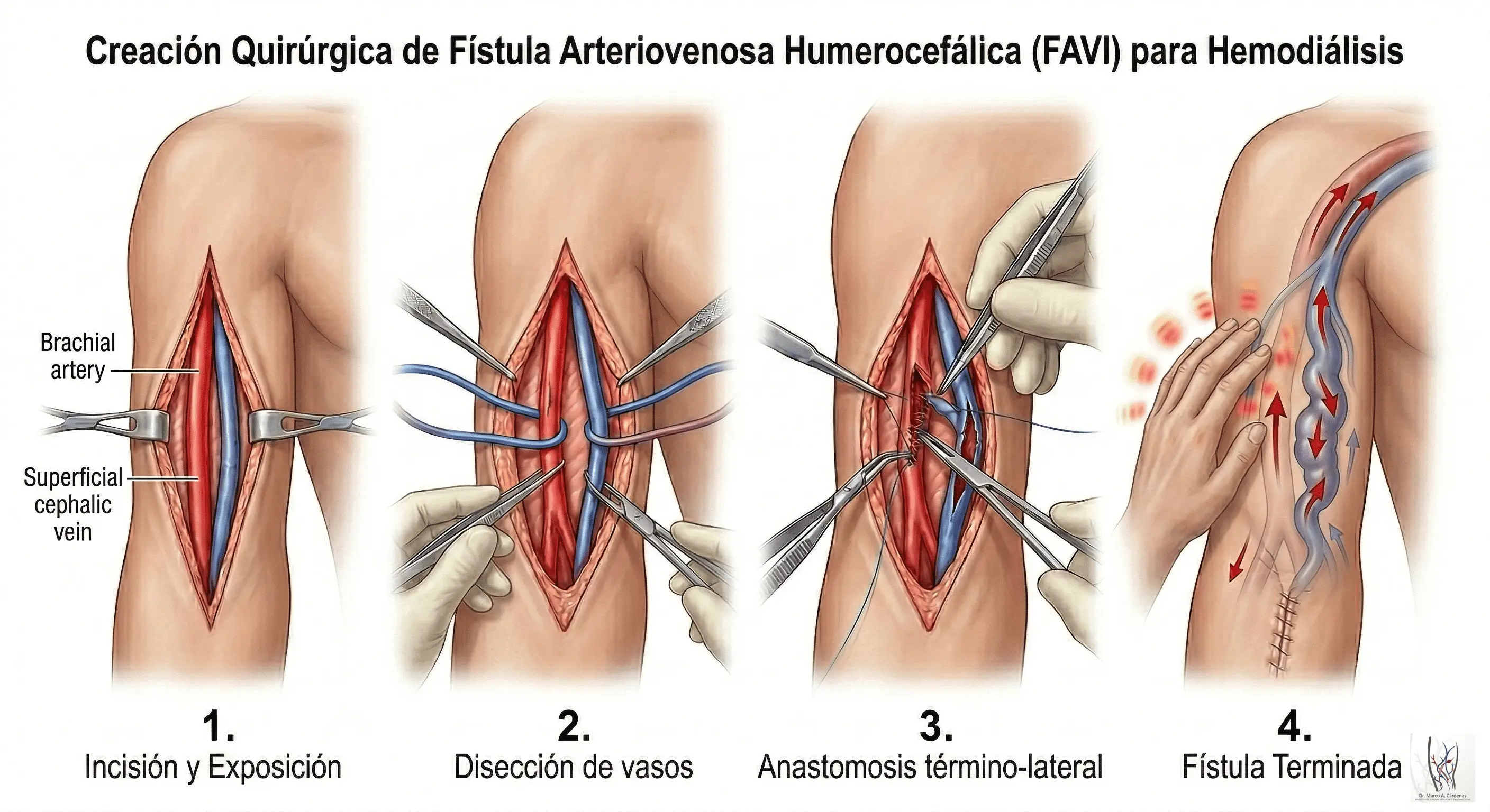 Construcción de FAVI